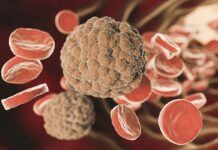 Nuevo diagnóstico rápido de sepsis Nuevo diagnóstico rápido de sepsis