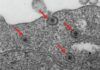 Descubren cómo frenar el rotavirus Descubren cómo frenar el rotavirus