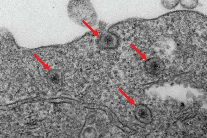 Descubren cómo frenar el rotavirus