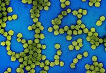 Detectan diez años antes el cáncer de cabeza y cuello asociado al VPH Detectan diez años antes el cáncer de cabeza y cuello asociados al VPH