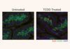 ¿Por qué fumar favorece la aparición de cáncer de páncreas? Fumar favorece la aparición de cáncer de páncreas