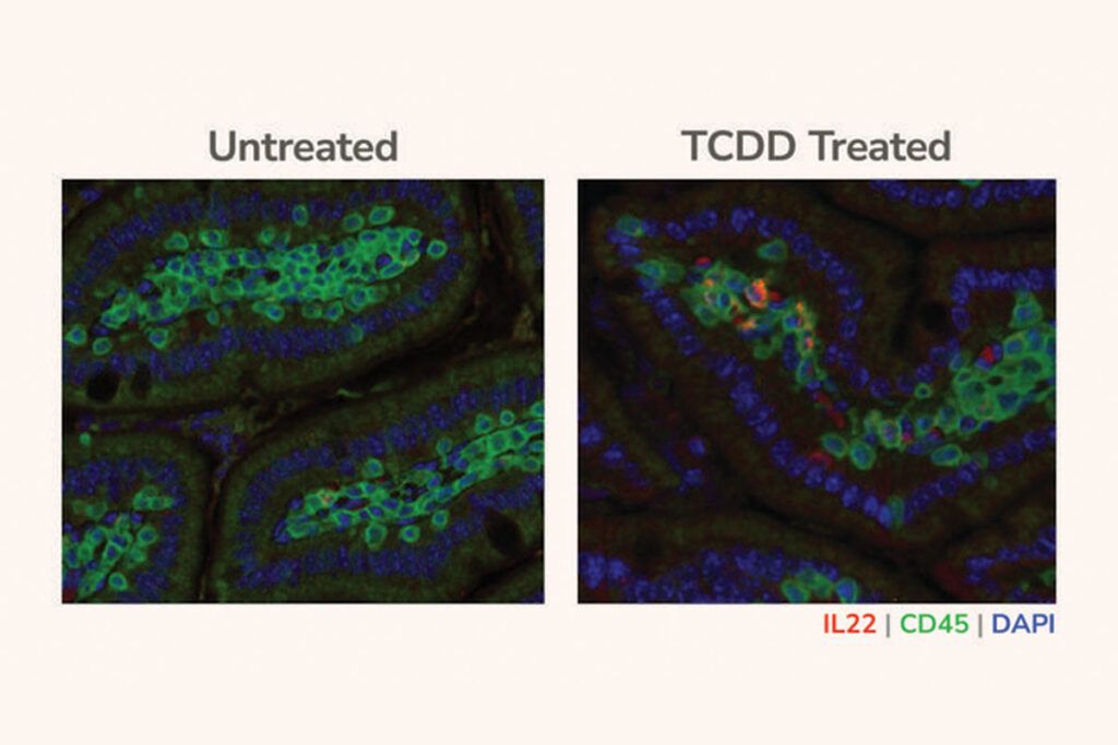 Fumar favorece la aparición de cáncer de páncreas