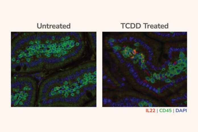 cancer-pancreas Fumar favorece la aparición de cáncer de páncreas