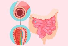Regeneran el revestimiento del intestino delgado con una dieta Regeneran el revestimiento del intestino delgado con una dieta