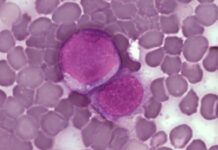 ¿Cómo la leucemia engaña al sistema inmunitario? ¿Cómo la leucemia engaña al sistema inmunitario?