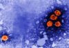 EE UU ya no vacuna a los neonatos contra el virus B de la hepatitis EE UU ya no vacuna a los neonatos contra el virus B de la hepatitis