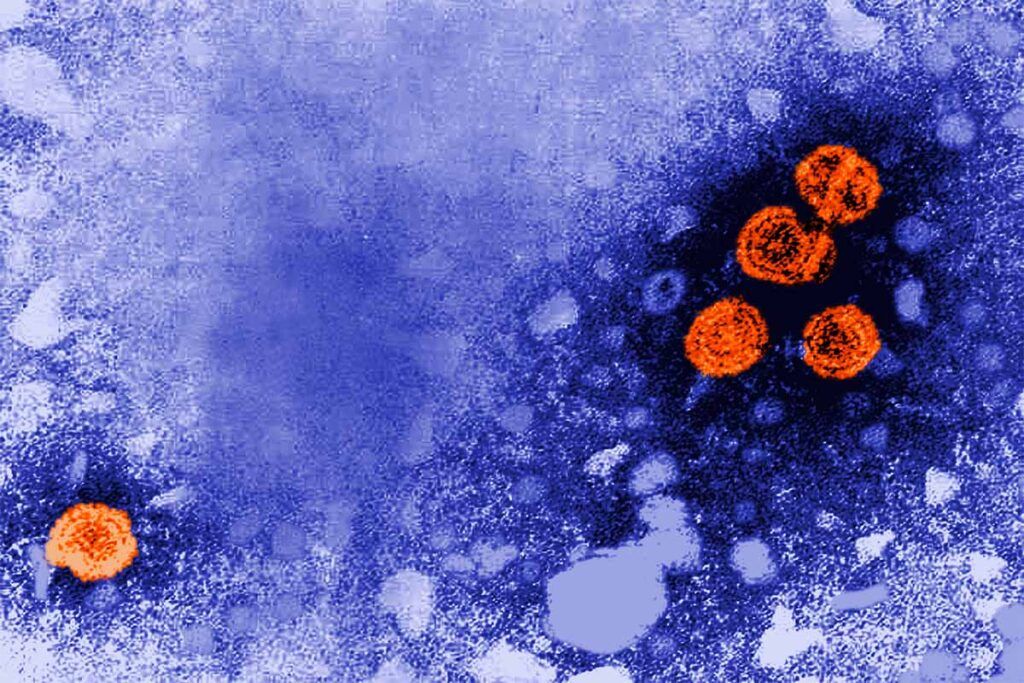 EE UU ya no vacuna a los neonatos contra el virus B de la hepatitis
