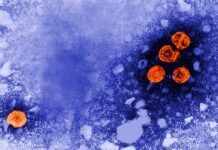 EE UU ya no vacuna a los neonatos contra el virus B de la hepatitis EE UU ya no vacuna a los neonatos contra el virus B de la hepatitis