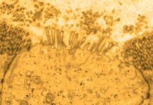 ¿Son las células M las responsables de la enfermedad celíaca? Las células M podrían desempeñar un papel central en la enfermedad celiaca