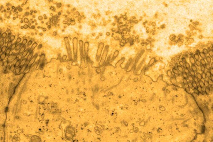 celulas m Las células M podrían desempeñar un papel central en la enfermedad celiaca