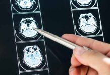 ¿Puede estar el cerebro relacionado con la hipertensión? ¿Puede estar el cerebro relacionado con la hipertensión?