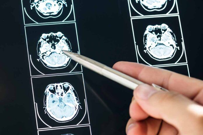 ¿Puede estar el cerebro relacionado con la hipertensión?
