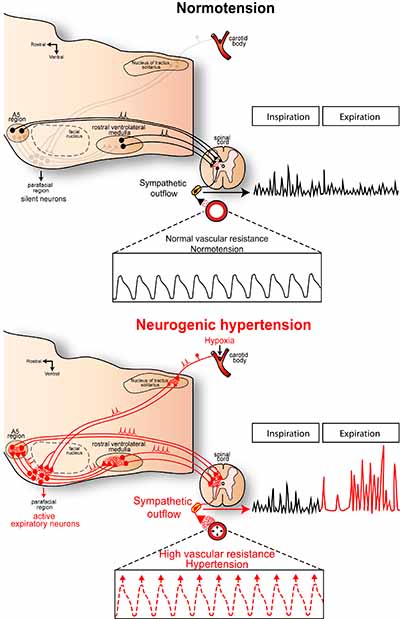 ¿Puede estar el cerebro relacionado con la hipertensión?