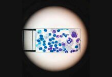 Descubren cómo la leucemia engaña al sistema inmunitario Descubren cómo la leucemia engaña al sistema inmunitario