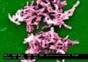 Hacia un nuevo antibiótico contra la superbacteria ‘C.diff’, principal causa de muerte por gastroenteritis Hacia un nuevo antibiótico contra la superbacteria C.diff, principal causa de muerte por gastroenteritis