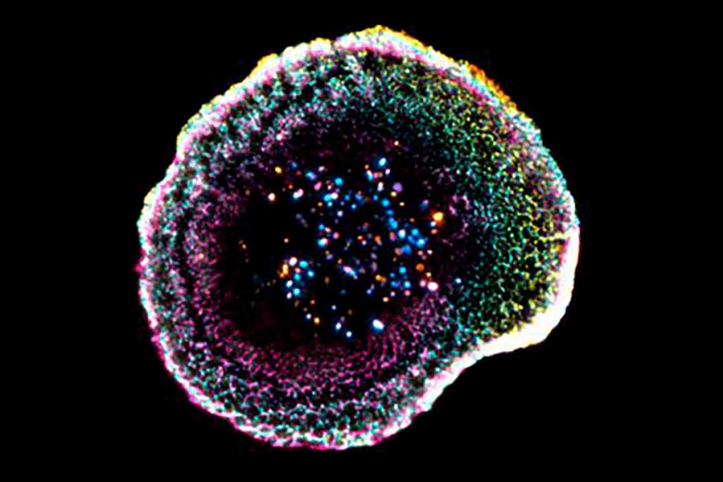 Visualizan por primera vez en 3D cómo el sistema inmune destruye células cancerosas