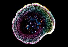Visualizan por primera vez en 3D cómo el sistema inmune destruye células cancerosas Visualizan por primera vez en 3D cómo el sistema inmune destruye células cancerosas