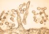 Hantavirus: alerta mundial ante riesgo zoonótico Hantavirus: alerta mundial ante riesgo zoonótico