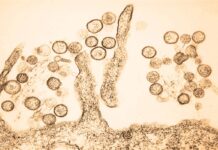 Hantavirus: alerta mundial ante riesgo zoonótico Hantavirus: alerta mundial ante riesgo zoonótico