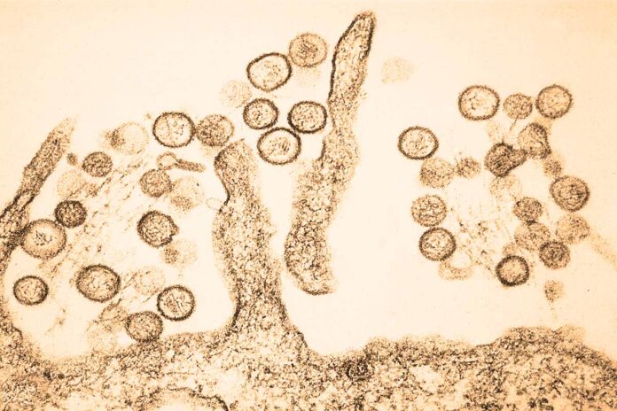 Hantavirus: alerta mundial ante riesgo zoonótico