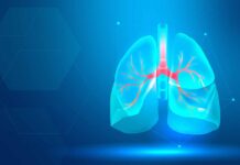 Cerco al cáncer de pulmón Cerco al cáncer de pulmón