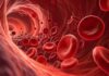 Nuevo análisis de sangre que detecta riesgo de leucemia Nuevo análisis de sangre que detecta riesgo de leucemia