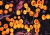 La OMS activa su nueva reserva mundial de vacunas frente a mpox La OMS activa su nueva reserva mundial de vacunas frente a mpox