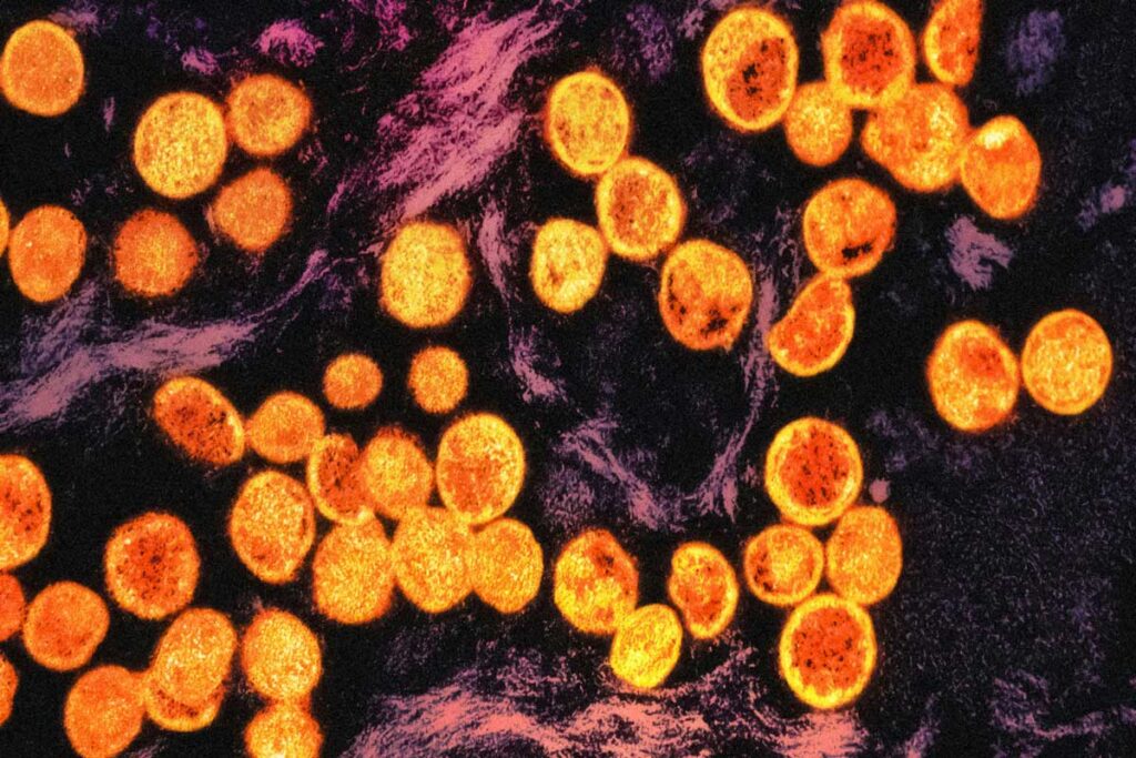 La OMS activa su nueva reserva mundial de vacunas frente a mpox