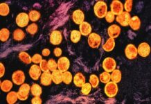 La OMS activa su nueva reserva mundial de vacunas frente a mpox La OMS activa su nueva reserva mundial de vacunas frente a mpox