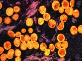 La OMS activa su nueva reserva mundial de vacunas frente a mpox La OMS activa su nueva reserva mundial de vacunas frente a mpox