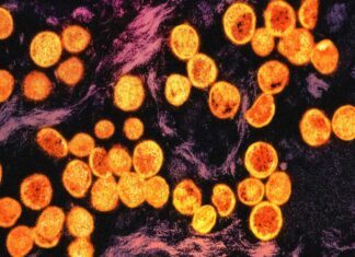 La OMS activa su nueva reserva mundial de vacunas frente a mpox La OMS activa su nueva reserva mundial de vacunas frente a mpox
