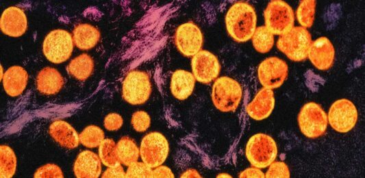 La OMS activa su nueva reserva mundial de vacunas frente a mpox La OMS activa su nueva reserva mundial de vacunas frente a mpox