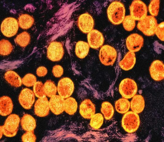 La OMS activa su nueva reserva mundial de vacunas frente a mpox La OMS activa su nueva reserva mundial de vacunas frente a mpox