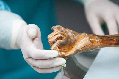 Ötzi, algo más que una reliquia congelada
