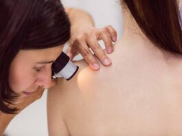 Un ‘tatuaje inteligente’ para detectar melanoma antes de que aparezca Un ‘tatuaje inteligente’ para detectar melanoma antes de que aparezca