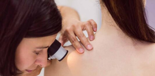 Un ‘tatuaje inteligente’ para detectar melanoma antes de que aparezca Un ‘tatuaje inteligente’ para detectar melanoma antes de que aparezca