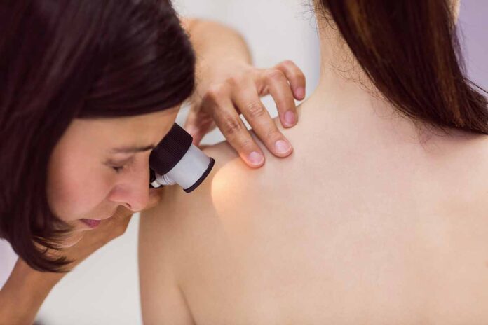 Un ‘tatuaje inteligente’ para detectar melanoma antes de que aparezca
