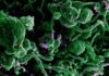 La primera vacuna para la fiebre de Lassa es eficaz La primera vacuna para la fiebre de Lassa es eficaz