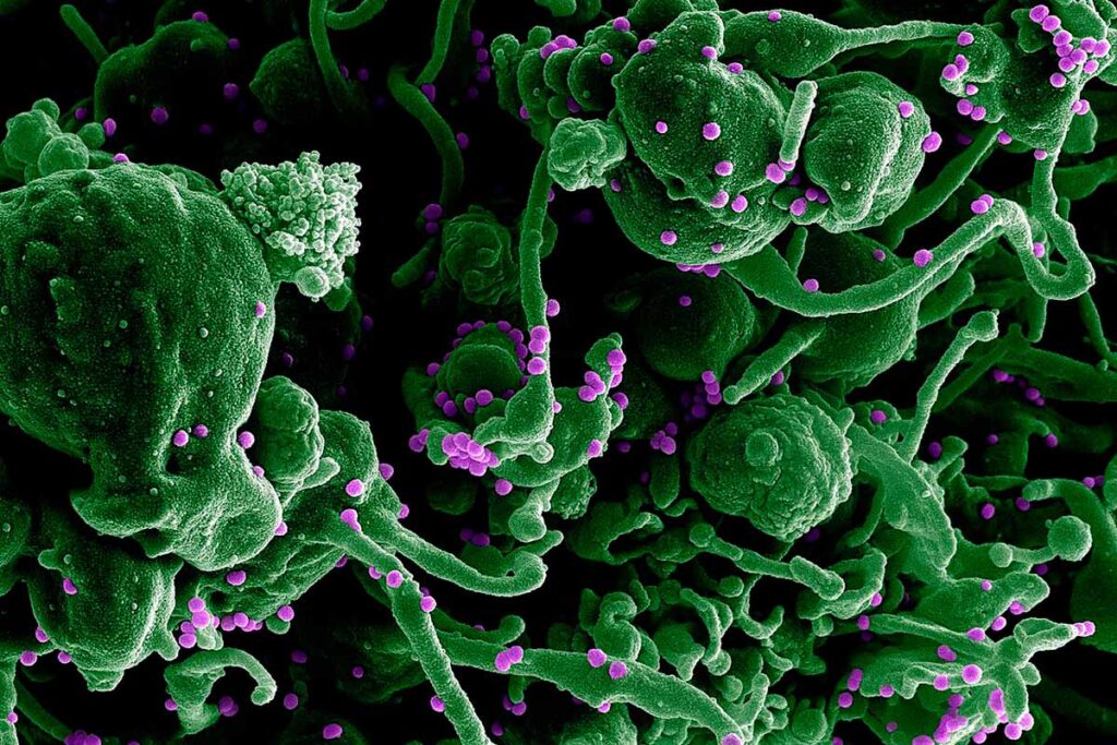 La primera vacuna para la fiebre de Lassa es eficaz