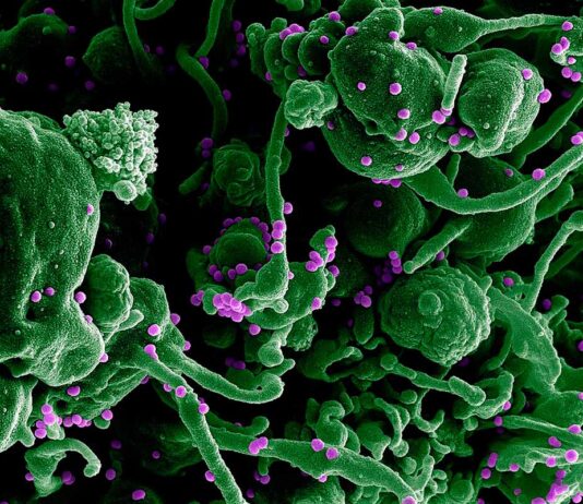 La primera vacuna para la fiebre de Lassa es eficaz La primera vacuna para la fiebre de Lassa es eficaz