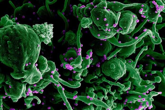 La primera vacuna para la fiebre de Lassa es eficaz